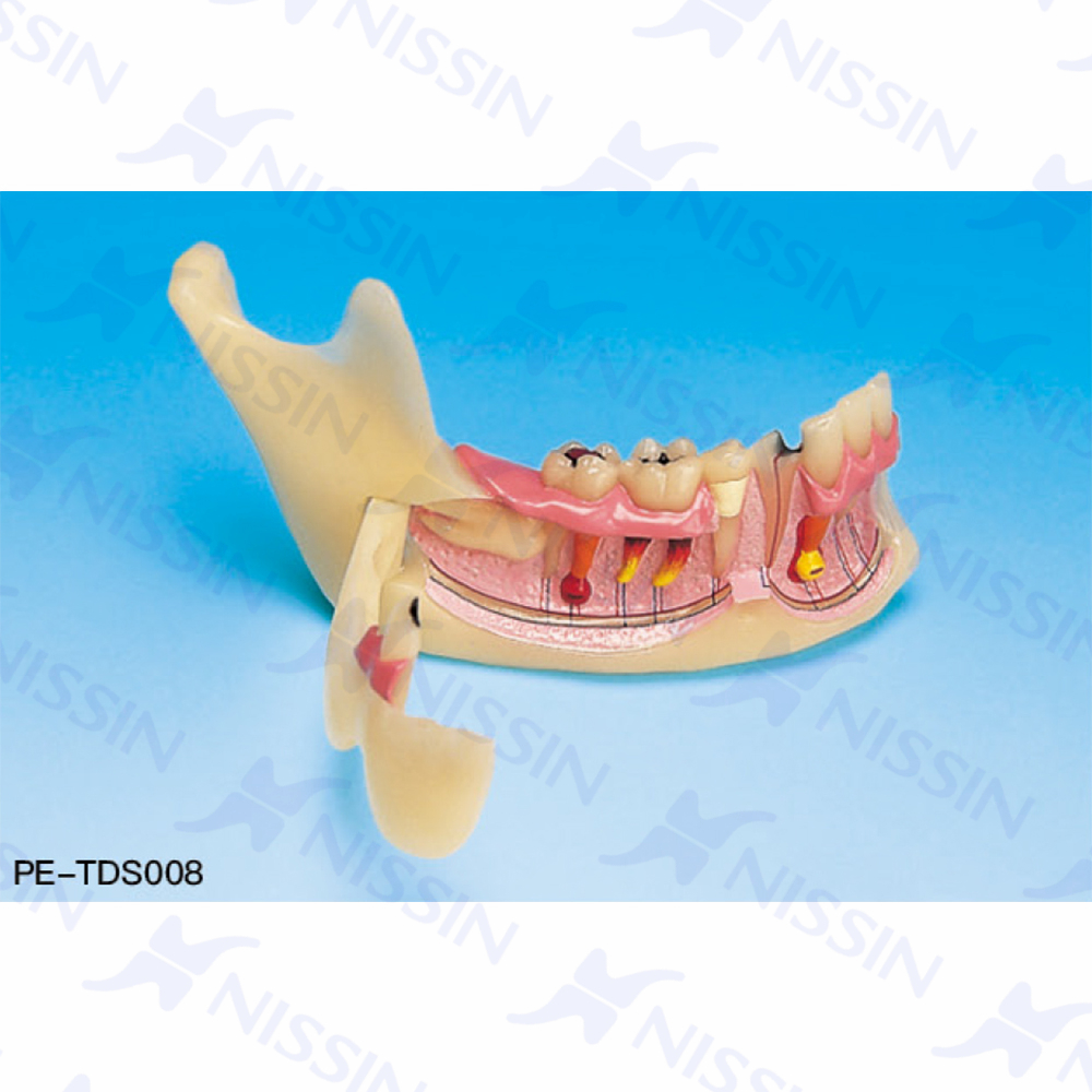 下頜骨組織模型