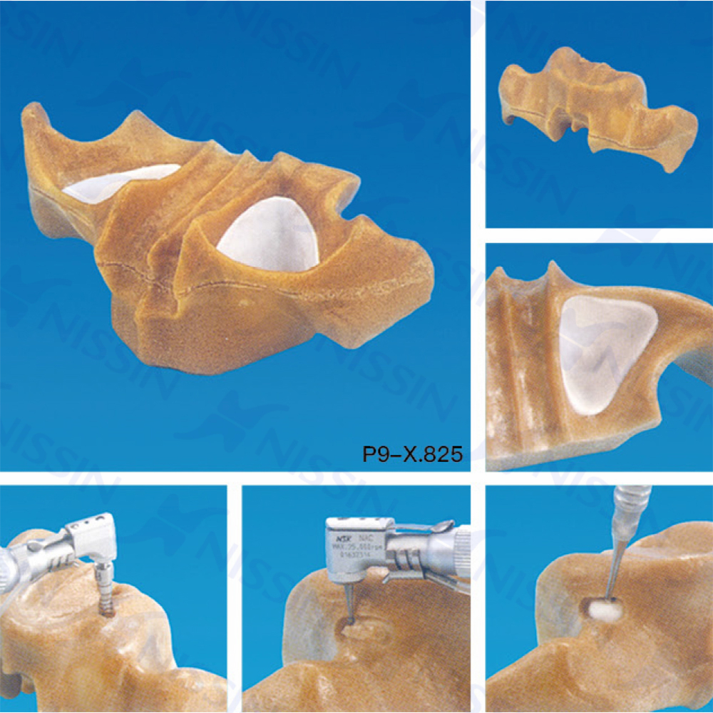 上頜竇底提升實(shí)習(xí)用模型