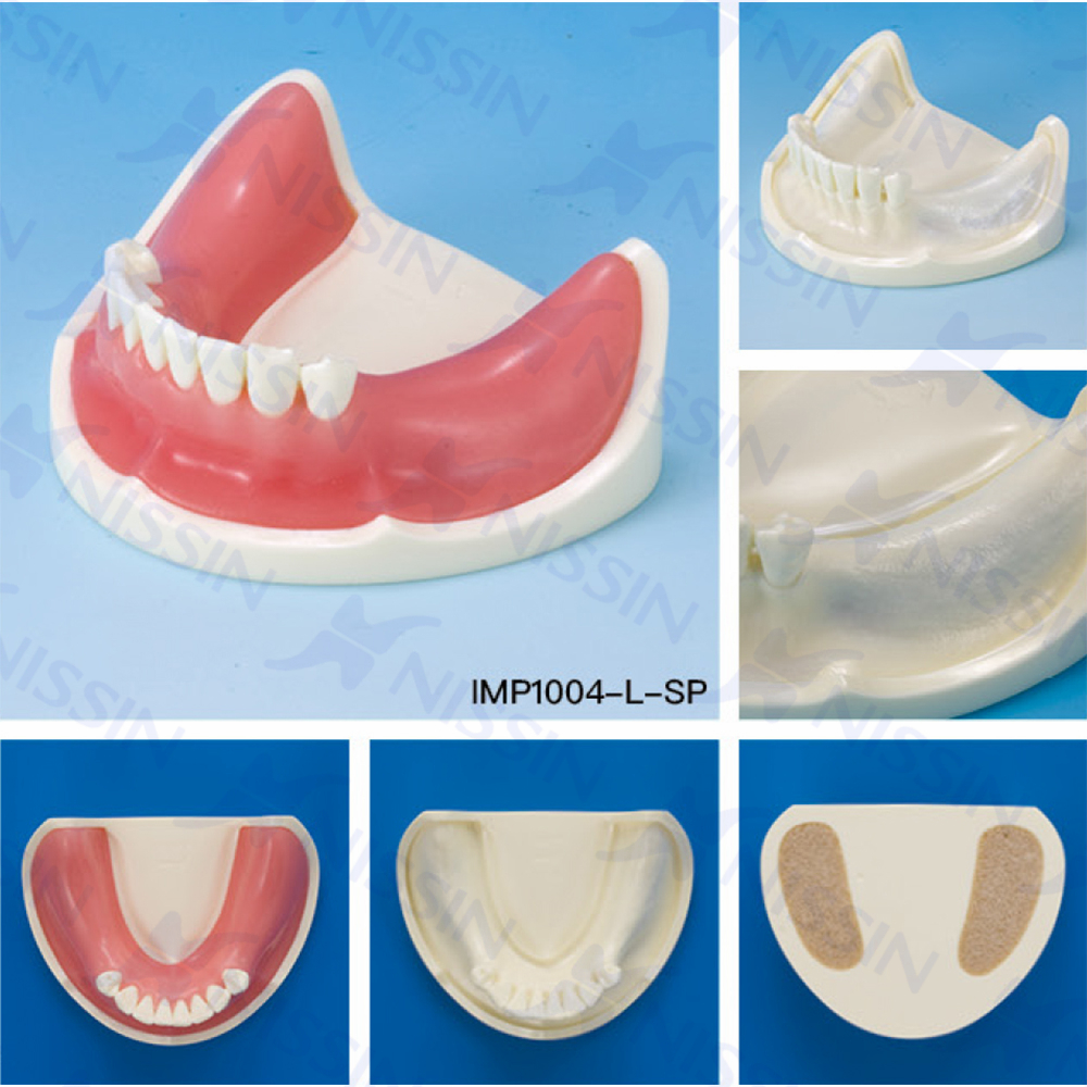 種植實(shí)習(xí)用牙頜模型
